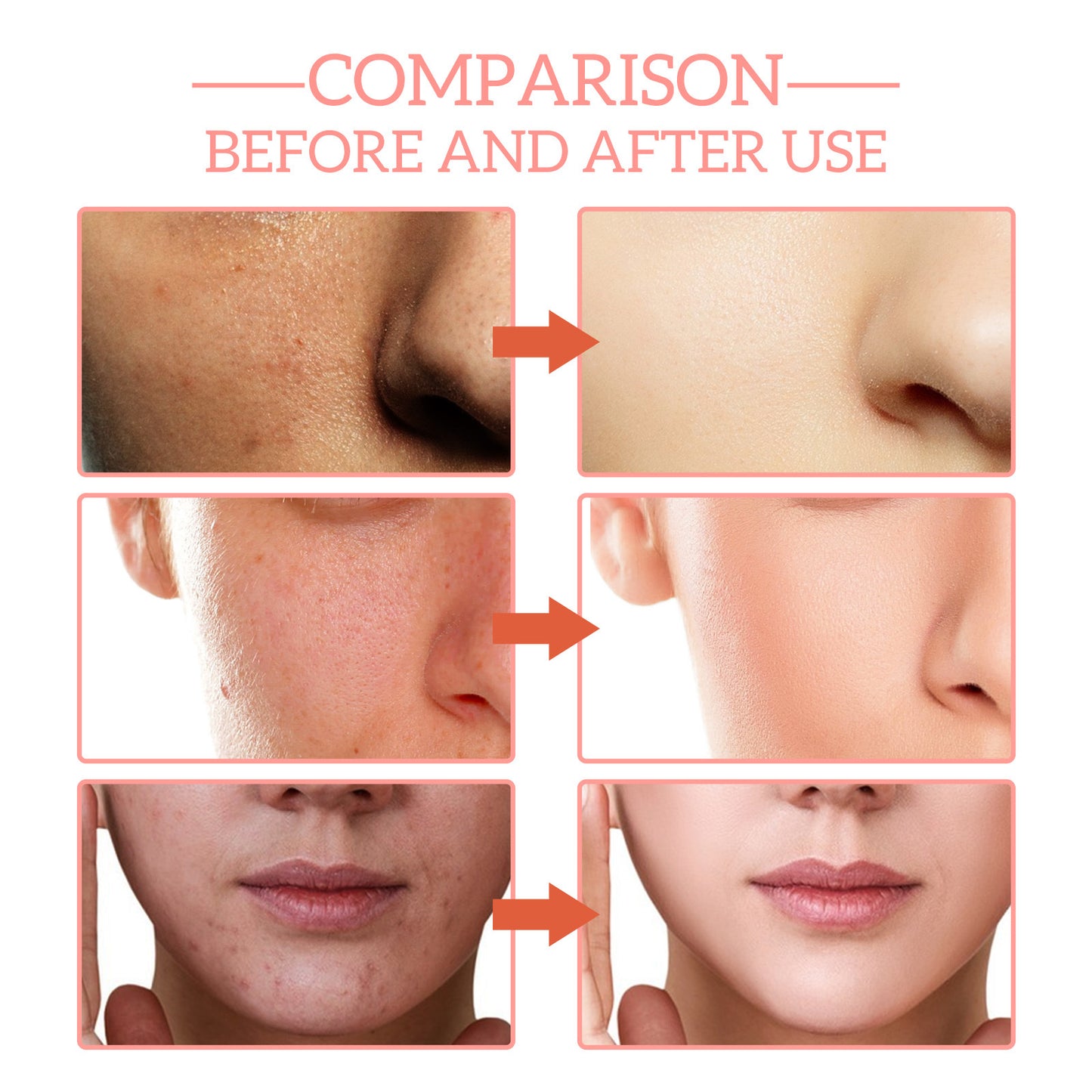 Moisturizing Skin Anti-wrinkle Firming Fade Spots 5-in-1 Facial - E-LUSH